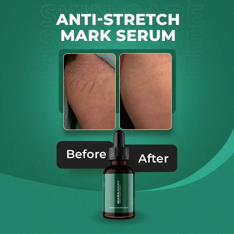 Mark Away Strech Mark Serum